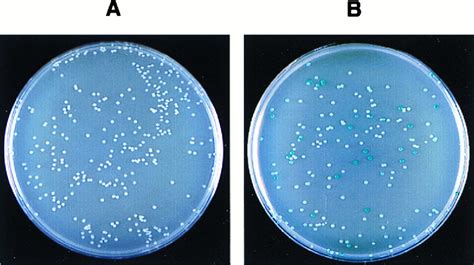 bacteria 2+意思|Urology